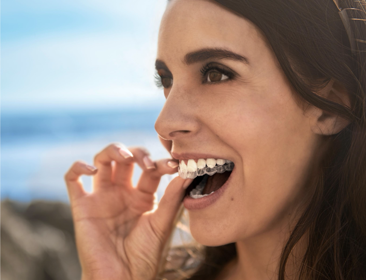 Alineadores Invisalign