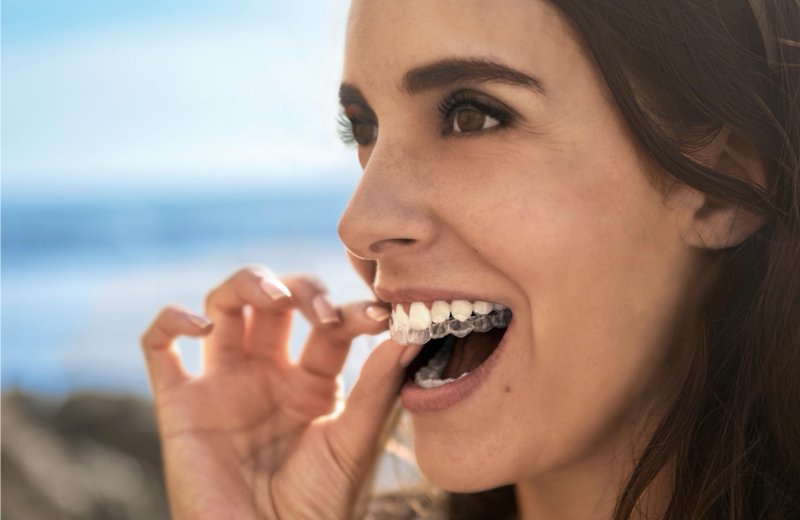 Alineadores Invisalign