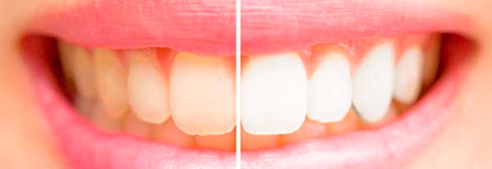 Estética dental